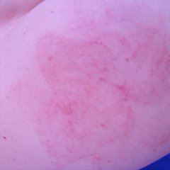 Spanking